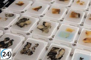 El Hospital Clínic optimiza tiempos en biopsias gracias a la tecnología de microtomía robótica: -30% en respuesta.